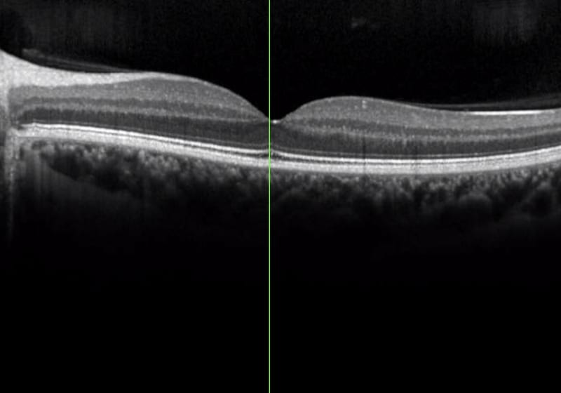 Vorsorge - Sonographie Aufnahme